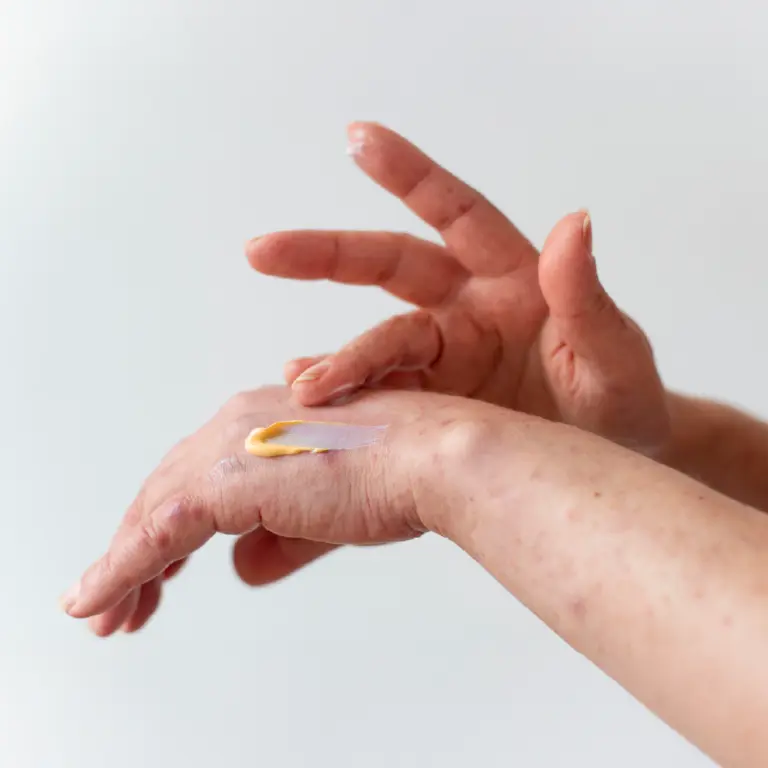 best cream for psoriasis
