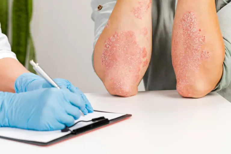 gloved-dermatologist-examines-skin-sick-patient-records-observations-examination-diagnosis-skin-diseasesallergies-psoriasis-eczema-dermatitis-min