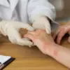 psoriasis cream